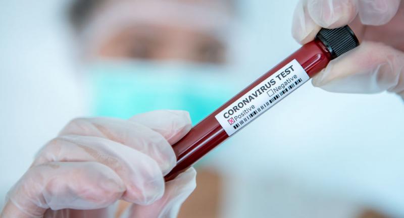 Respublikinėje Kauno ligoninėje pirmą kartą nustatyta koronaviruso infekcija