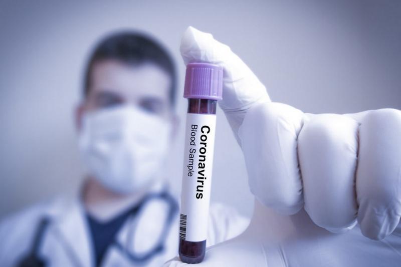 Nacionalinis visuomenės sveikatos centras pastoviai meluoja COVID-19 testais
